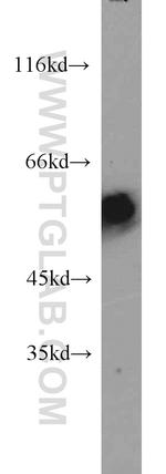 IA-2/PTPRN Antibody in Western Blot (WB)