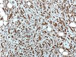 NOB1 Antibody in Immunohistochemistry (Paraffin) (IHC (P))