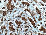 NOB1 Antibody in Immunohistochemistry (Paraffin) (IHC (P))