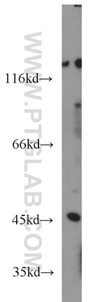 NOB1 Antibody in Western Blot (WB)