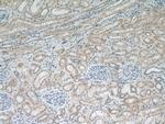 NDUFS5 Antibody in Immunohistochemistry (Paraffin) (IHC (P))