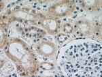 NDUFS5 Antibody in Immunohistochemistry (Paraffin) (IHC (P))