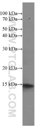 NDUFS5 Antibody in Western Blot (WB)