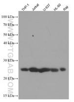ARHGDIB Antibody in Western Blot (WB)