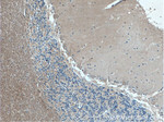 ARHGDIB Antibody in Immunohistochemistry (Paraffin) (IHC (P))