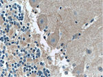 ARHGDIB Antibody in Immunohistochemistry (Paraffin) (IHC (P))