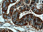 RACGAP1 Antibody in Immunohistochemistry (Paraffin) (IHC (P))