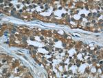 Cofilin Antibody in Immunohistochemistry (Paraffin) (IHC (P))