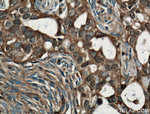 Cofilin Antibody in Immunohistochemistry (Paraffin) (IHC (P))