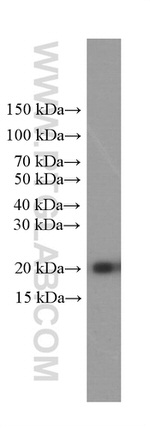 Cofilin Antibody in Western Blot (WB)