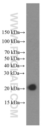 Cofilin Antibody in Western Blot (WB)