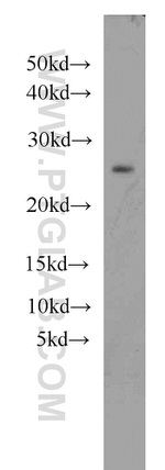 RAB27A Antibody in Western Blot (WB)