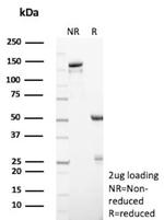 Survival of motor neuron 1, telomeric (SMN1 )/Gemin 1 Antibody in SDS-PAGE (SDS-PAGE)