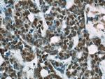 RBAP48 Antibody in Immunohistochemistry (Paraffin) (IHC (P))