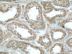 RBAP48 Antibody in Immunohistochemistry (Paraffin) (IHC (P))