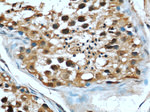 RBAP48 Antibody in Immunohistochemistry (Paraffin) (IHC (P))