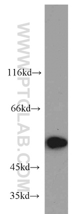 RBAP48 Antibody in Western Blot (WB)