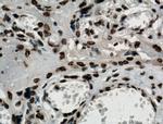 NTF2 Antibody in Immunohistochemistry (Paraffin) (IHC (P))