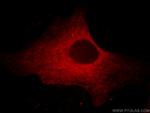 CAPZA1 Antibody in Immunocytochemistry (ICC/IF)