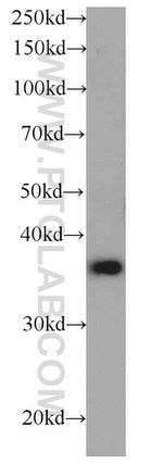 CAPZA1 Antibody in Western Blot (WB)