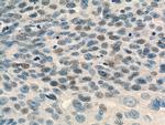 USP1 Antibody in Immunohistochemistry (Paraffin) (IHC (P))