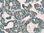 USP1 Antibody in Immunohistochemistry (Paraffin) (IHC (P))