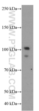USP1 Antibody in Western Blot (WB)