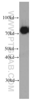 CPT1C Antibody in Western Blot (WB)