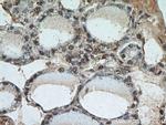 PAX8 Antibody in Immunohistochemistry (Paraffin) (IHC (P))
