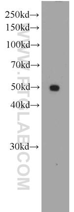 PAX8 Antibody in Western Blot (WB)