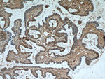 PAX8 Antibody in Immunohistochemistry (Paraffin) (IHC (P))