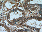 PAX8 Antibody in Immunohistochemistry (Paraffin) (IHC (P))