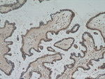 PAX8 Antibody in Immunohistochemistry (Paraffin) (IHC (P))