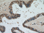 PAX8 Antibody in Immunohistochemistry (Paraffin) (IHC (P))