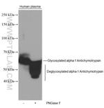 alpha 1 Antichymotrypsin Antibody in Western Blot (WB)