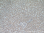 alpha 1 Antichymotrypsin Antibody in Immunohistochemistry (Paraffin) (IHC (P))