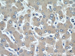 alpha 1 Antichymotrypsin Antibody in Immunohistochemistry (Paraffin) (IHC (P))