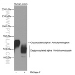 alpha 1 Antichymotrypsin Antibody in Western Blot (WB)