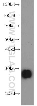 Serum amyloid P component Antibody in Western Blot (WB)