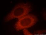 FHIT Antibody in Immunocytochemistry (ICC/IF)