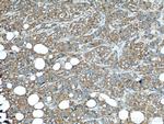 FHIT Antibody in Immunohistochemistry (Paraffin) (IHC (P))