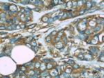 FHIT Antibody in Immunohistochemistry (Paraffin) (IHC (P))