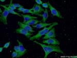 Factor XII Antibody in Immunocytochemistry (ICC/IF)