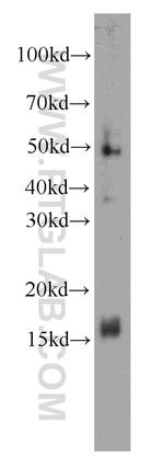 FKBP2 Antibody in Western Blot (WB)