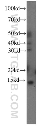 FKBP2 Antibody in Western Blot (WB)