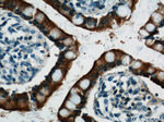 Villin Antibody in Immunohistochemistry (Paraffin) (IHC (P))