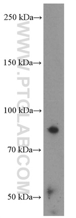 Villin Antibody in Western Blot (WB)
