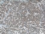 S100A6 Antibody in Immunohistochemistry (Paraffin) (IHC (P))