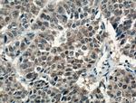 S100A6 Antibody in Immunohistochemistry (Paraffin) (IHC (P))