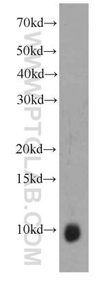 S100A6 Antibody in Western Blot (WB)